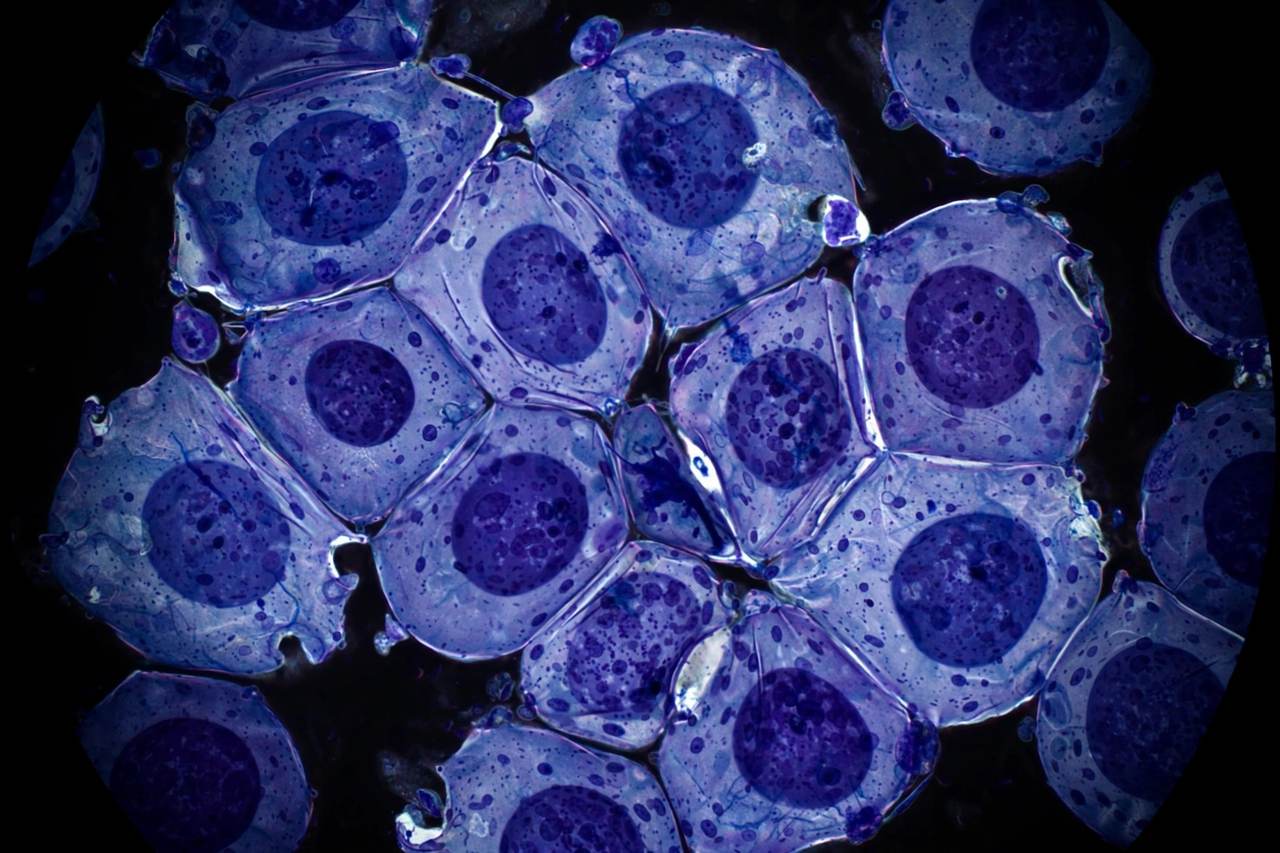 Cells under the microscope